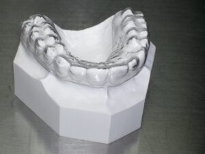 essix thermo formed overlay dental retainer