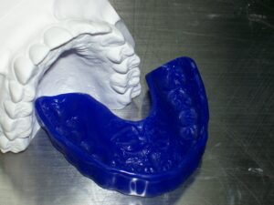Fox Valley Orthodontic Laboratory Sports mouthguard