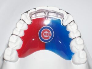 Orthodontic Modified Spring Aligner for Anterior Tooth Movement