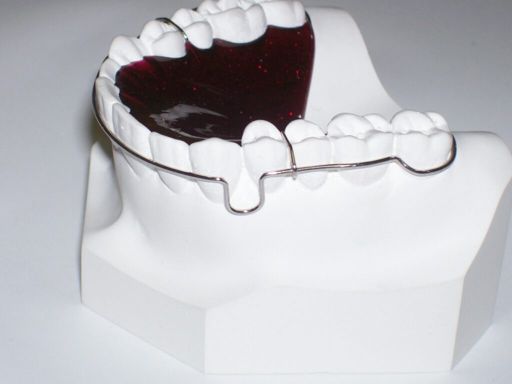 Orthodontics Lab - Wraparound Retainer