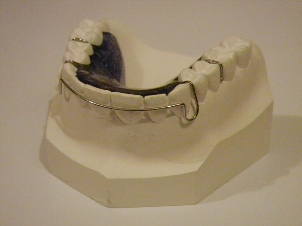 Hawley Retainer with clasps
