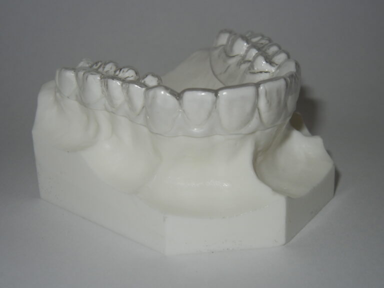 Essix (Invisible) thermoformed orthodontic retainer - Fox Valley Orthodontic Laboratory