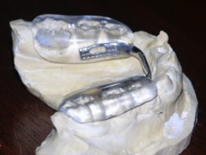 Posterior bite pads - Gelb-splint