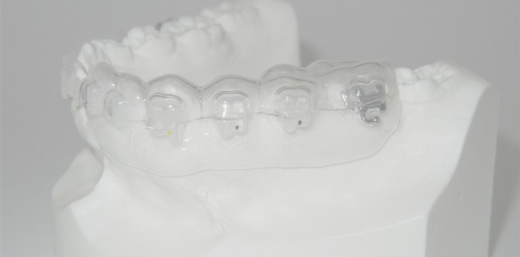 Orthodontic Braces Indirect Bonding Tray