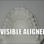 ORTHODONTIC INVISIBLE-ALIGNERS