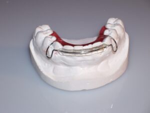 Orthodontic Spring Hawley Retainer for Anterior Tooth Movement
