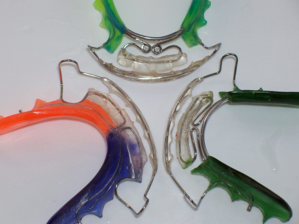 Spring retainers - Fox Valley orthodontic laboratory