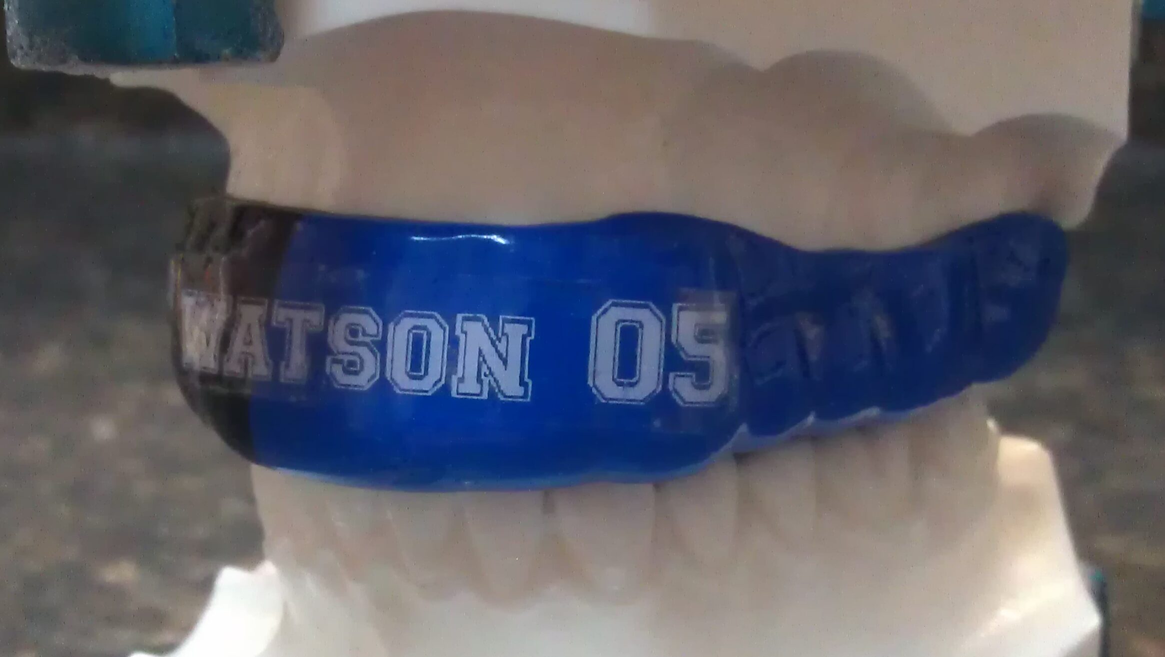 Custom Sports Specific Mouth Guard