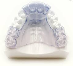 Theroux Phase One Retainer - Fox Valley Orthodontic Laboratory